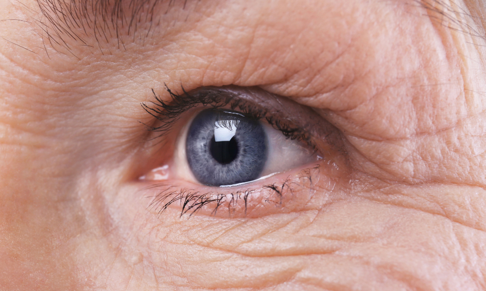 Common Questions After Cataract Surgery: Part 2