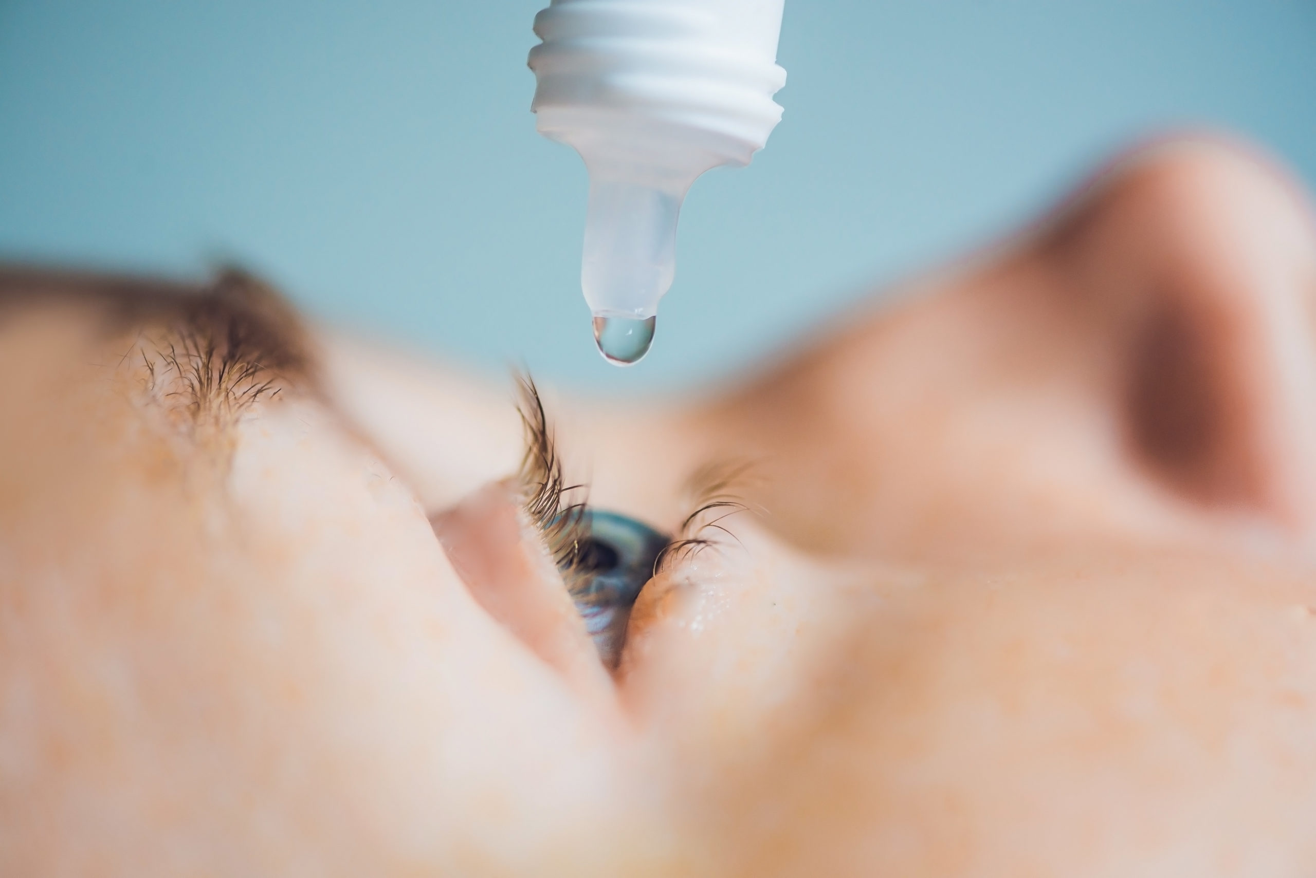 Pink Eye, Allergies and Dry Eyes: What’s the Difference?